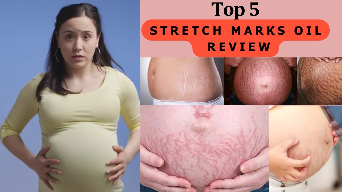best oil for stretch marks